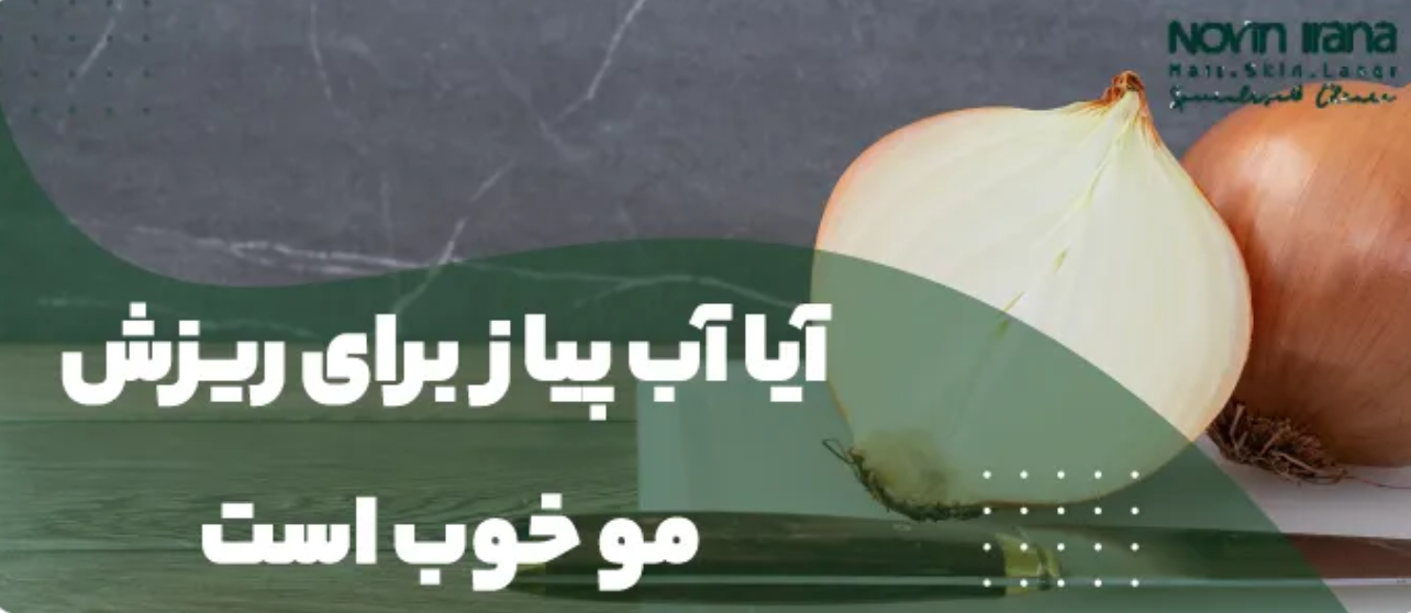 تأثیر پیاز در بهبود عملکرد کاشت مو