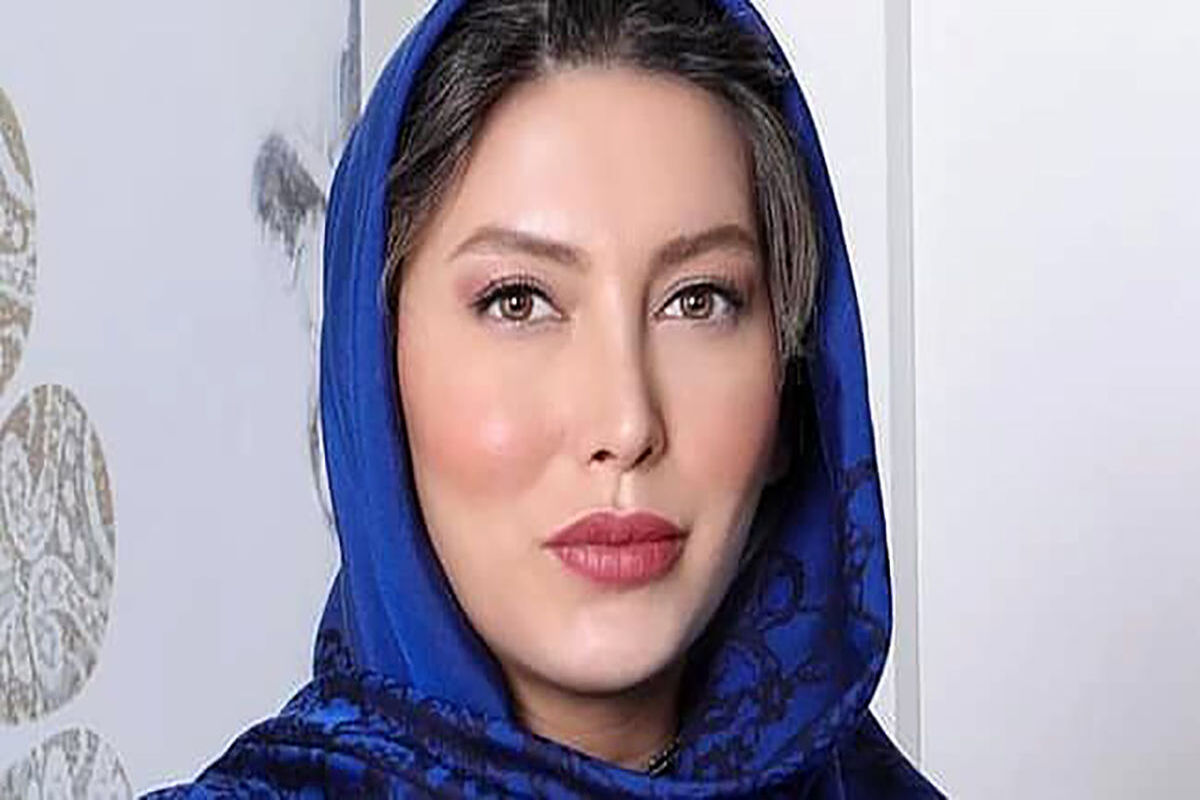 تغییر چهره عجیب فریبا نادری قبل از عمل بینی/ عکس
