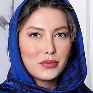 تغییر چهره عجیب فریبا نادری قبل از عمل بینی/ عکس