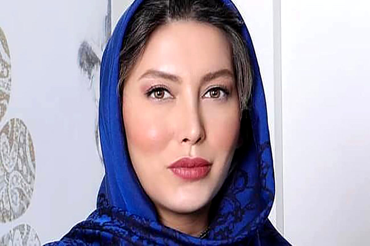 تغییر چهره عجیب فریبا نادری قبل از عمل بینی/ عکس