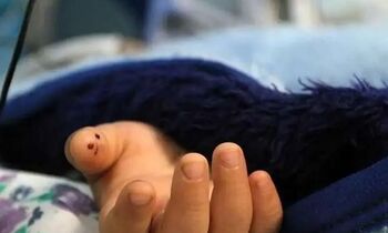 مرگ دختر ۳ساله بر اثر عقرب‌ گزیدگی در قلعه گنج