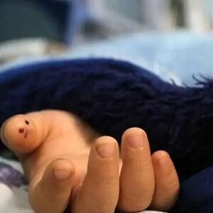 مرگ دختر ۳ساله بر اثر عقرب‌ گزیدگی در قلعه گنج