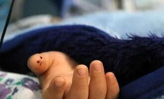 مرگ دختر ۳ساله بر اثر عقرب‌ گزیدگی در قلعه گنج