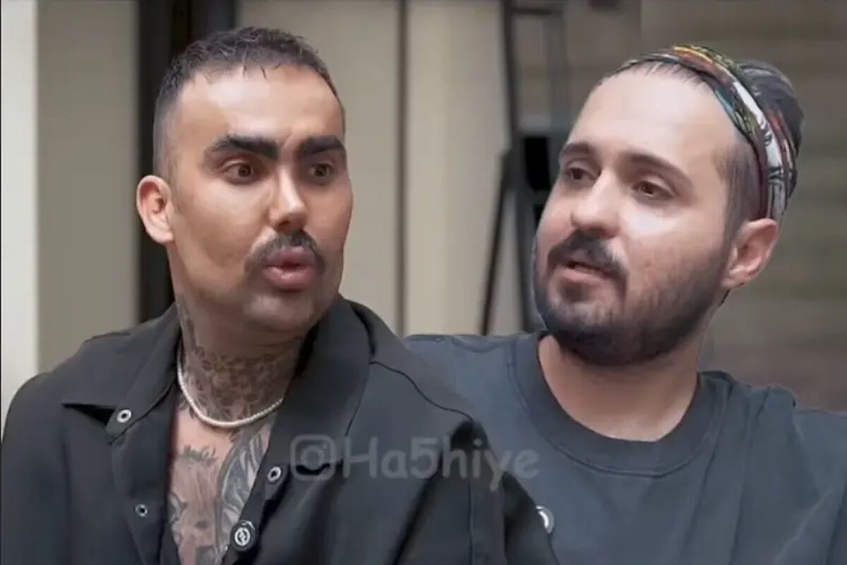 چهره پسر ایرانی که 300 عمل جراحی داشته است/ ویدئو