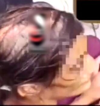عکس خبرساز از اتاق بستری دختر قربانی کودک آزاری در سنندج