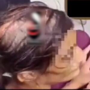 عکس خبرساز از اتاق بستری دختر قربانی کودک آزاری در سنندج