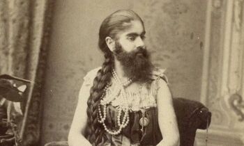 نوزادی دختری که با سبیل به دنیا آمد!/ عکس
