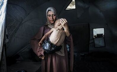 تصاویری هولناک از قحطی،گرسنگی و مرگ در غزه