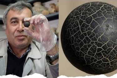 کهن‌ترین پروتز جهان در «قوطی کبریت» نگهداری می‌شود!