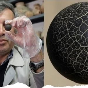 کهن‌ترین پروتز جهان در «قوطی کبریت» نگهداری می‌شود!