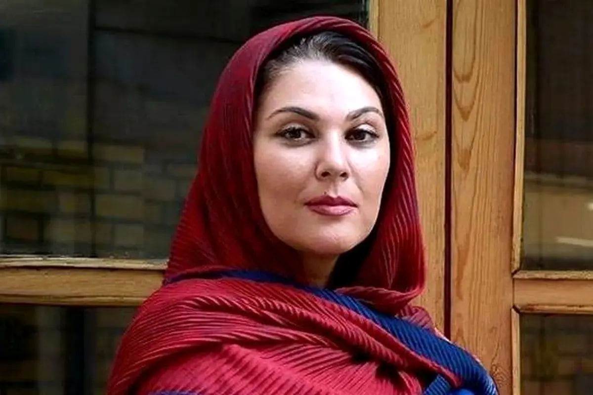 تغییر چهره لاله اسکندری بعد از عمل زیبایی/ ویدئو