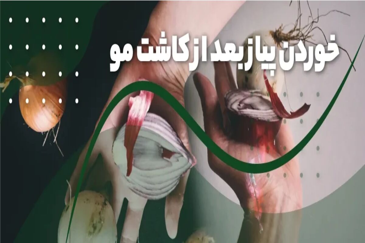 خوردن پیاز بعد از کاشت مو
