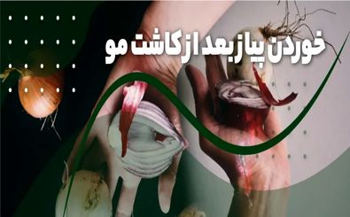 خوردن پیاز بعد از کاشت مو
