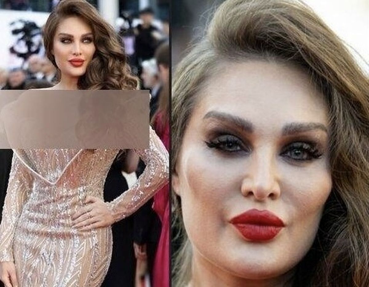 چهره واقعی طلا گلزار ؛ فیلترهای که شکست خوردند