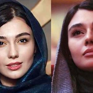  ونوس کانلی: به خاطر زیبایی چهره ام از یک پروژه کنار گذاشته شدم/ ویدئو