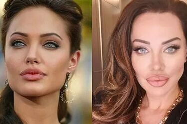 خواننده زن ترک خودش را شبیه آنجلینا جولی کرد/ عکس