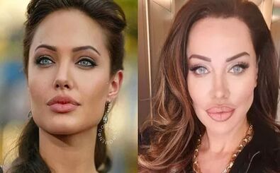 خواننده زن ترک خودش را شبیه آنجلینا جولی کرد/ عکس