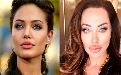 خواننده زن ترک خودش را شبیه آنجلینا جولی کرد/ عکس