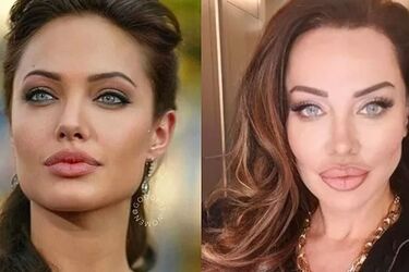 خواننده زن ترک خودش را شبیه آنجلینا جولی کرد/ عکس