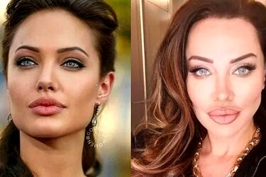 خواننده زن ترک خودش را شبیه آنجلینا جولی کرد/ عکس