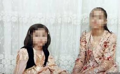 وضعیت دختر سنندجی پس از سه هفته درمان/ عکس قبل و بعد