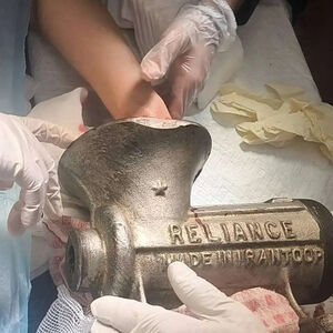  قطع شدن انگشتان دست زن تهرانی در چرخ گوشت روشن/ ویدئو