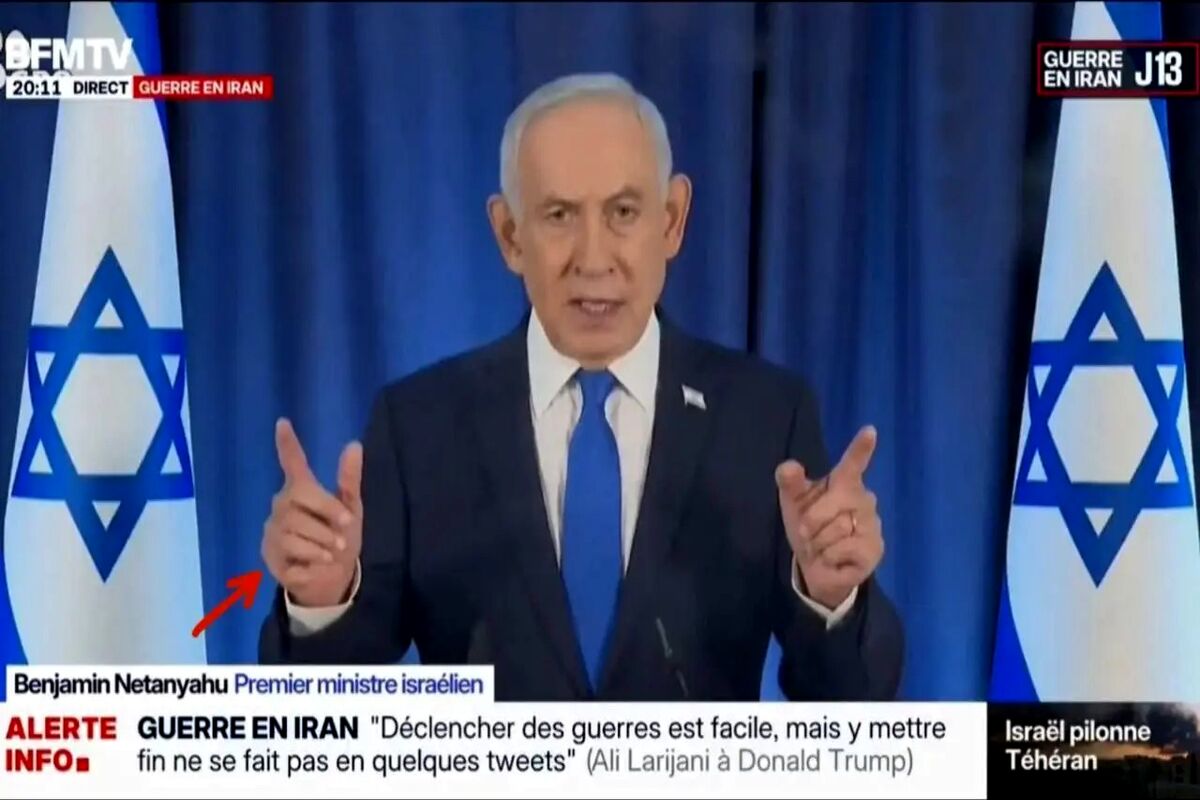 انگشتِ ششم نتانیاهو خبرساز شد/ عکس