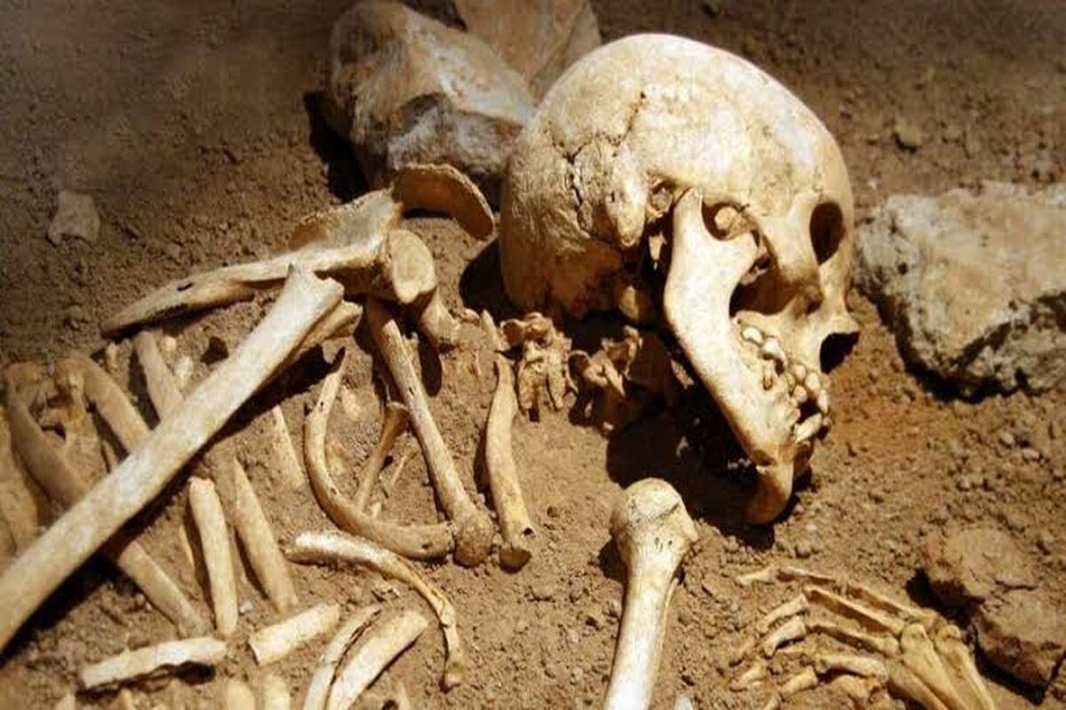 تصاویر مراحل تجزیه جسد انسان پس از مرگ +18