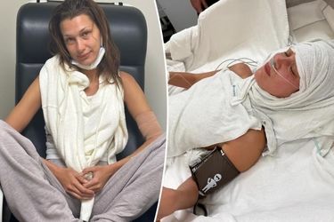  بلا حدید بالاخره از بیماری‌اش گفت