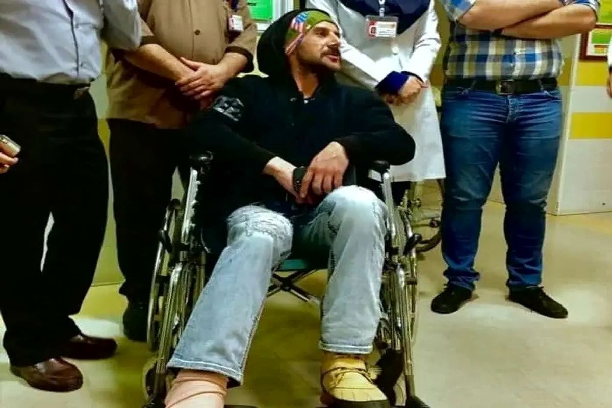 شکنجه‌های بازیگر شدن: از کاهش محسوس وزن، طلاق، قطع عضو تا پرت شدن از ارتفاع